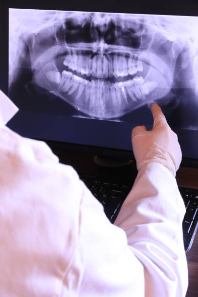 Best Emergency Gum Treatment in Hermann, MO