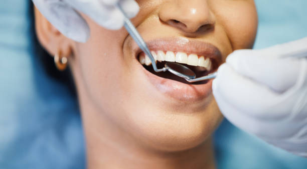 Best Emergency Treatment for Dental Infections or Abscesses in Hermann, MO